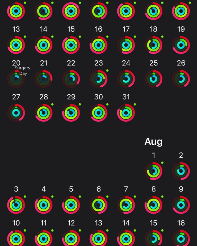 Activity tracker showing Julie’s daily movement during breast surgery recovery