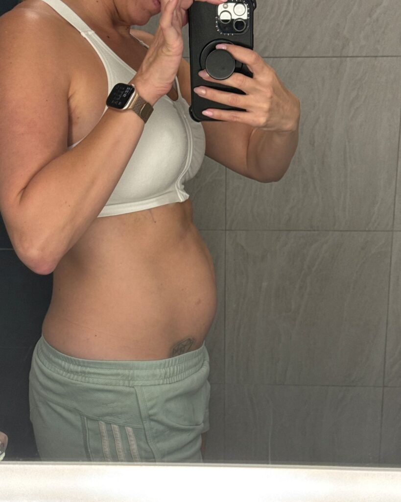 Julie showing abdominal bloating during the first week of breast surgery recovery
